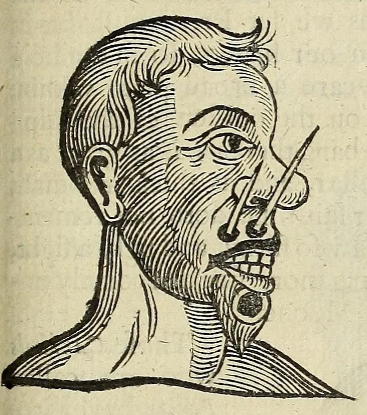 An illustration from Anthropometamorphosis: man transform'd: or, The artificiall changling, historically presented, in the mad and cruel gallantry, foolish bravery, ridiculous beauty, filthy finenesse, and loathsome loveliness of most nations, fashioning and altering their bodies from the mould intended by nature; with figures of those transformations. To which artificial and affected deformations are added, all the native and national monstrosities that have appeared to disfigure the humane fabrick. With a vindication of the regular beauty and honesty of nature, 1653, leaf 235