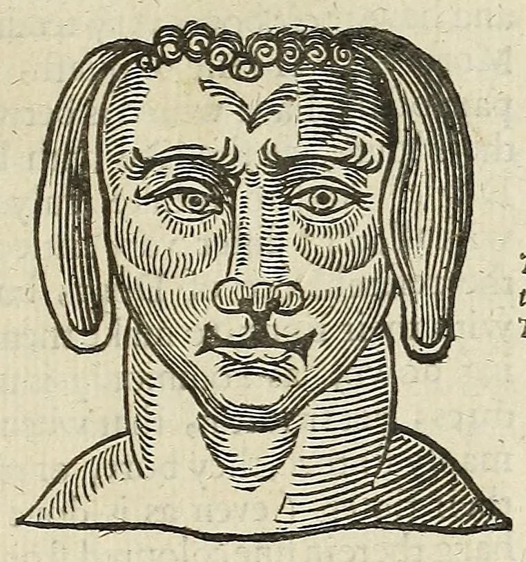 An illustration from Anthropometamorphosis: man transform'd: or, The artificiall changling, historically presented, in the mad and cruel gallantry, foolish bravery, ridiculous beauty, filthy finenesse, and loathsome loveliness of most nations, fashioning and altering their bodies from the mould intended by nature; with figures of those transformations. To which artificial and affected deformations are added, all the native and national monstrosities that have appeared to disfigure the humane fabrick. With a vindication of the regular beauty and honesty of nature, 1653, leaf 303