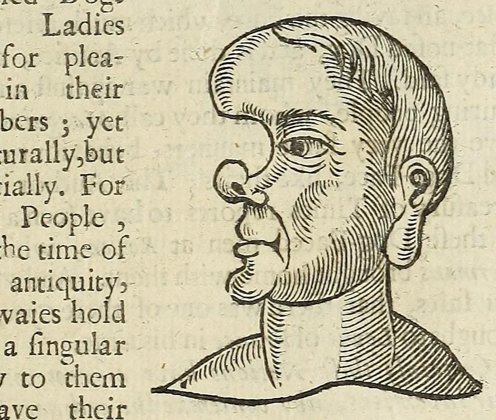 An illustration from Anthropometamorphosis: man transform'd: or, The artificiall changling, historically presented, in the mad and cruel gallantry, foolish bravery, ridiculous beauty, filthy finenesse, and loathsome loveliness of most nations, fashioning and altering their bodies from the mould intended by nature; with figures of those transformations. To which artificial and affected deformations are added, all the native and national monstrosities that have appeared to disfigure the humane fabrick. With a vindication of the regular beauty and honesty of nature, 1653, leaf 303