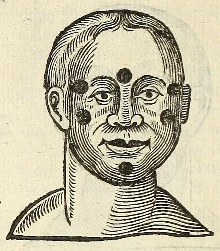 An illustration from Anthropometamorphosis: man transform'd: or, The artificiall changling, historically presented, in the mad and cruel gallantry, foolish bravery, ridiculous beauty, filthy finenesse, and loathsome loveliness of most nations, fashioning and altering their bodies from the mould intended by nature; with figures of those transformations. To which artificial and affected deformations are added, all the native and national monstrosities that have appeared to disfigure the humane fabrick. With a vindication of the regular beauty and honesty of nature, 1653, leaf 310