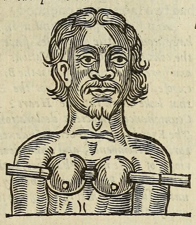 An illustration from Anthropometamorphosis: man transform'd: or, The artificiall changling, historically presented, in the mad and cruel gallantry, foolish bravery, ridiculous beauty, filthy finenesse, and loathsome loveliness of most nations, fashioning and altering their bodies from the mould intended by nature; with figures of those transformations. To which artificial and affected deformations are added, all the native and national monstrosities that have appeared to disfigure the humane fabrick. With a vindication of the regular beauty and honesty of nature, 1653, leaf 387