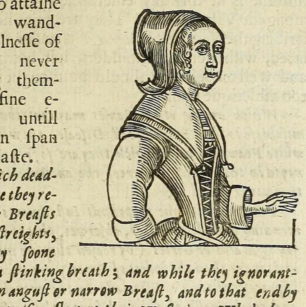 An illustration from Anthropometamorphosis: man transform'd: or, The artificiall changling, historically presented, in the mad and cruel gallantry, foolish bravery, ridiculous beauty, filthy finenesse, and loathsome loveliness of most nations, fashioning and altering their bodies from the mould intended by nature; with figures of those transformations. To which artificial and affected deformations are added, all the native and national monstrosities that have appeared to disfigure the humane fabrick. With a vindication of the regular beauty and honesty of nature, 1653, leaf 401