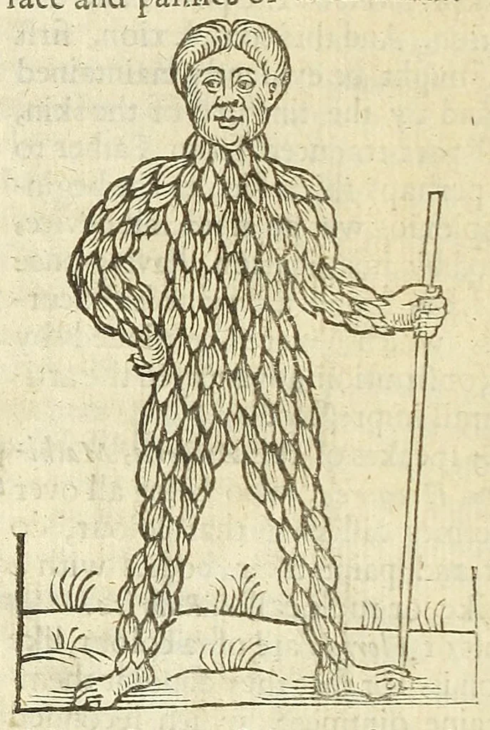 An illustration from Anthropometamorphosis: man transform'd: or, The artificiall changling, historically presented, in the mad and cruel gallantry, foolish bravery, ridiculous beauty, filthy finenesse, and loathsome loveliness of most nations, fashioning and altering their bodies from the mould intended by nature; with figures of those transformations. To which artificial and affected deformations are added, all the native and national monstrosities that have appeared to disfigure the humane fabrick. With a vindication of the regular beauty and honesty of nature, 1653, leaf 532