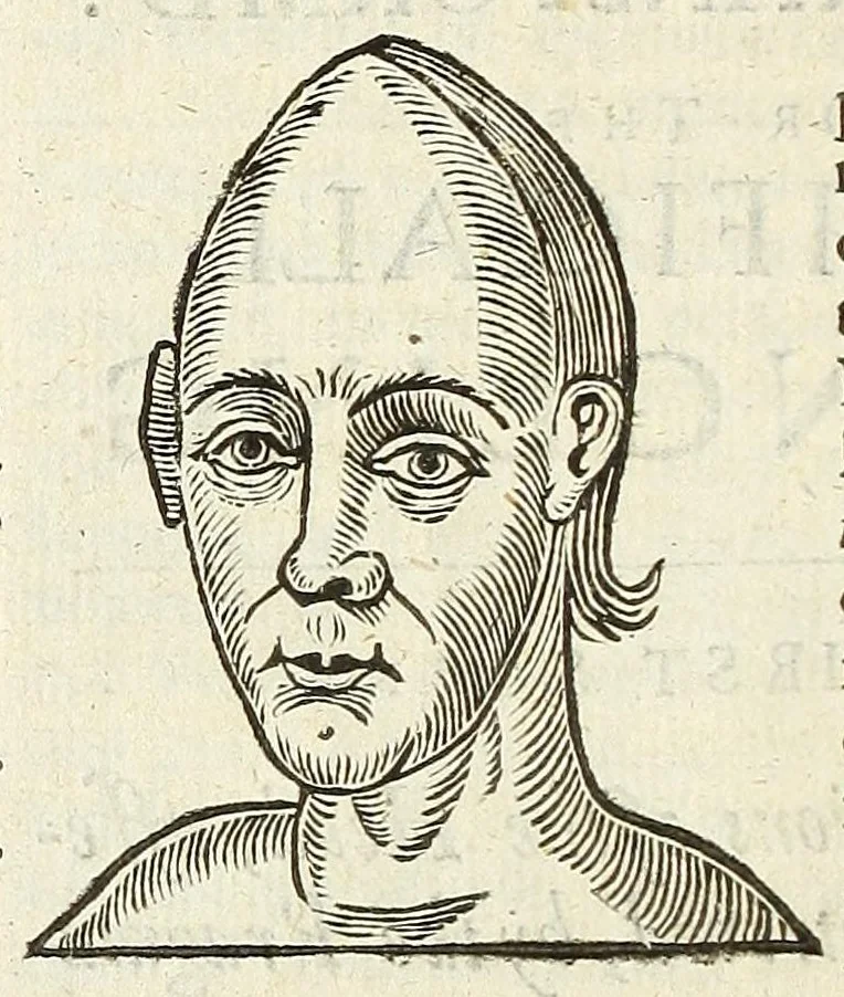 An illustration from Anthropometamorphosis: man transform'd: or, The artificiall changling, historically presented, in the mad and cruel gallantry, foolish bravery, ridiculous beauty, filthy finenesse, and loathsome loveliness of most nations, fashioning and altering their bodies from the mould intended by nature; with figures of those transformations. To which artificial and affected deformations are added, all the native and national monstrosities that have appeared to disfigure the humane fabrick. With a vindication of the regular beauty and honesty of nature, 1653, leaf 58