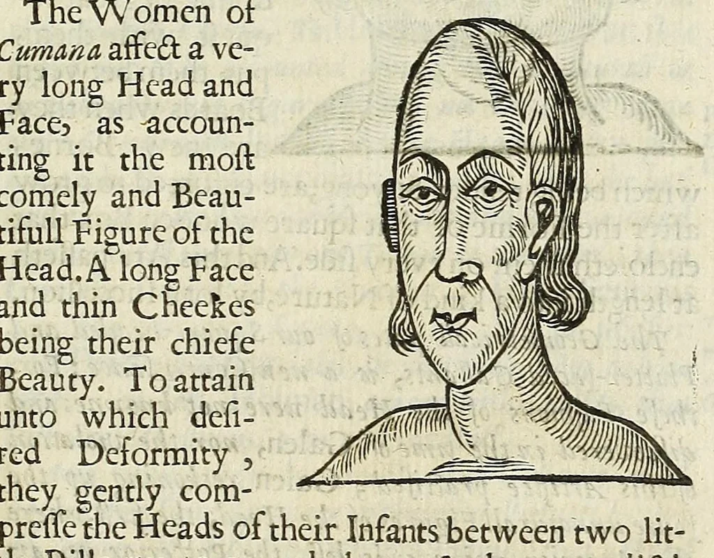 An illustration from Anthropometamorphosis: man transform'd: or, The artificiall changling, historically presented, in the mad and cruel gallantry, foolish bravery, ridiculous beauty, filthy finenesse, and loathsome loveliness of most nations, fashioning and altering their bodies from the mould intended by nature; with figures of those transformations. To which artificial and affected deformations are added, all the native and national monstrosities that have appeared to disfigure the humane fabrick. With a vindication of the regular beauty and honesty of nature, 1653, leaf 69