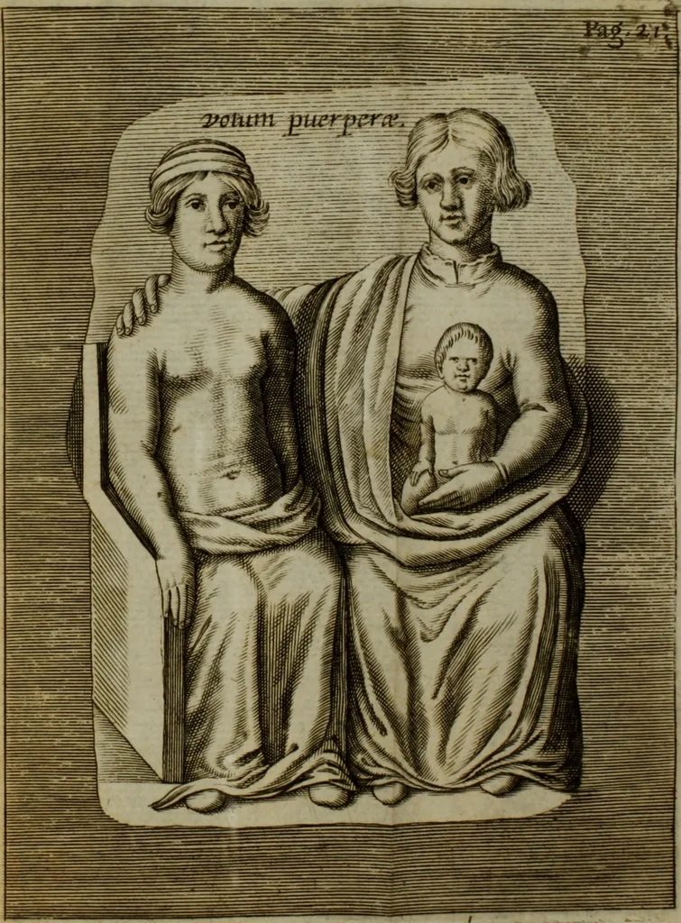 An illustration from Thomae Bartholini Antiqvitatvm Veteris pverperii synopsis a filio Casparo Bartholino commentario illustrata, 1676, leaf 49