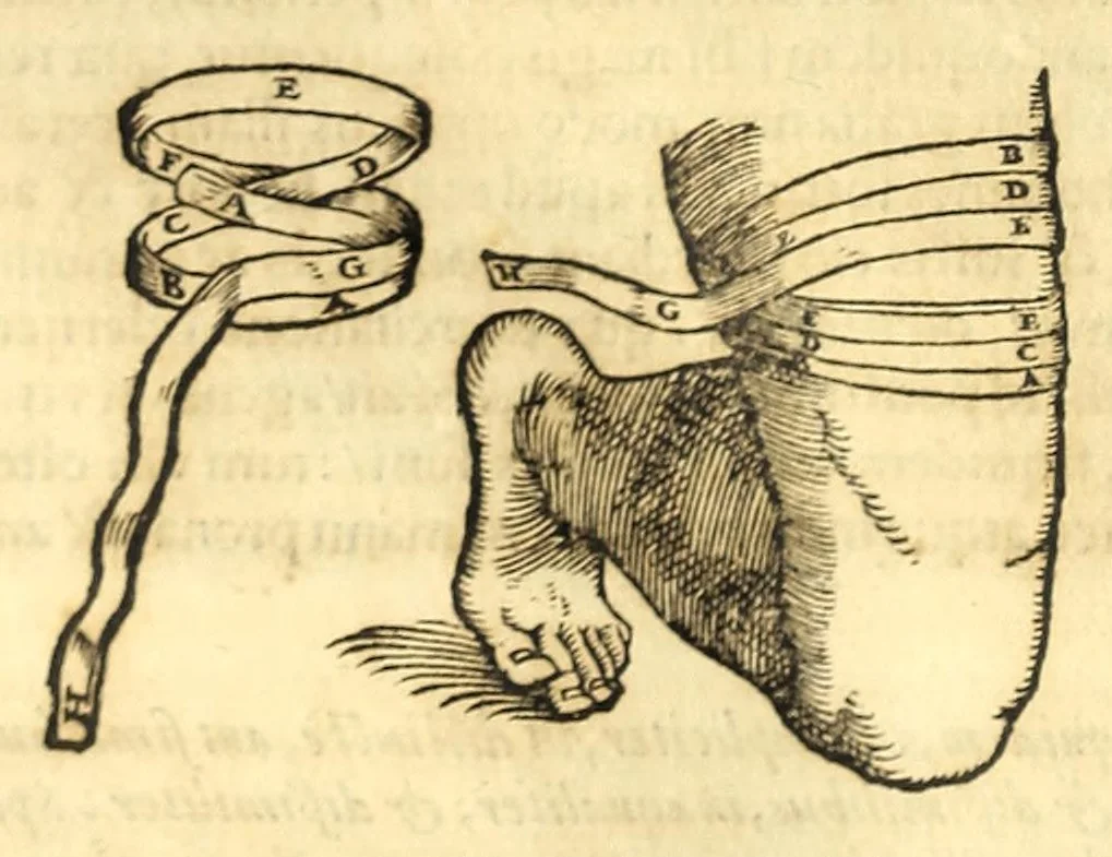 An illustration from Galeni librorum septima classis : curativum methodum tum diffuse tum breviter descriptam, victus rationem in morbis acutis, singulorum morborum facile paranda remedia, privatam quorundam morborum curationem, chirurgie constitutionem, fracturarum ac luxationum sanationem, fasciarum deniq ; & laqueorum & machinamentorum tractatum continet, 1576, leaf 432