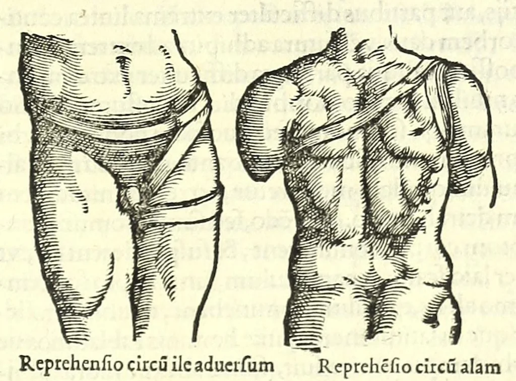An illustration from Galeni librorum septima classis : curativum methodum tum diffuse tum breviter descriptam, victus rationem in morbis acutis, singulorum morborum facile paranda remedia, privatam quorundam morborum curationem, chirurgie constitutionem, fracturarum ac luxationum sanationem, fasciarum deniq ; & laqueorum & machinamentorum tractatum continet, 1576, leaf 439