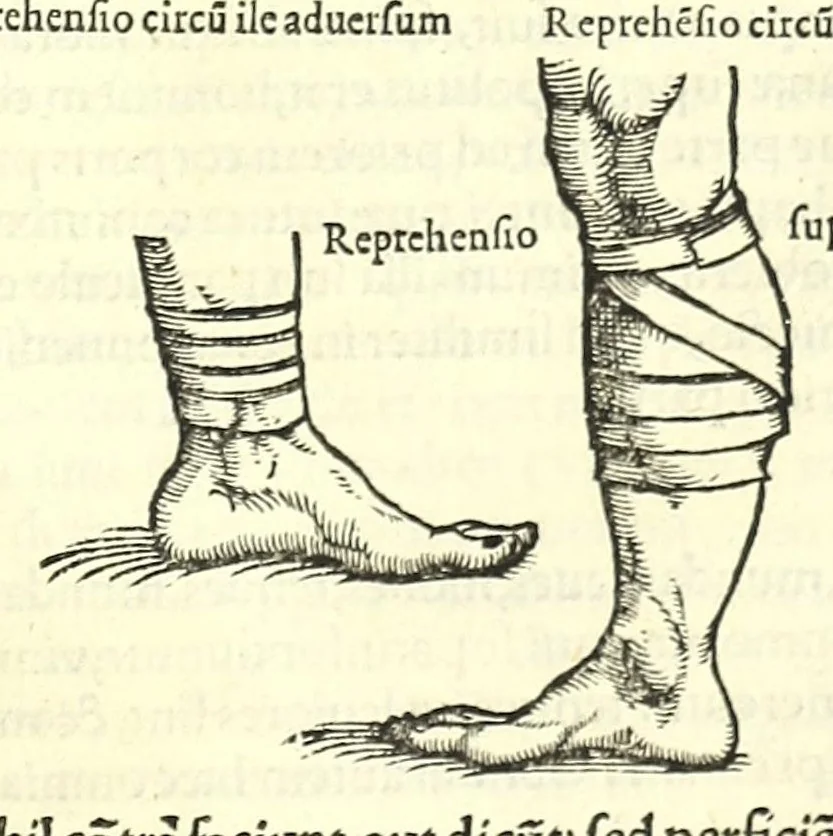 An illustration from Galeni librorum septima classis : curativum methodum tum diffuse tum breviter descriptam, victus rationem in morbis acutis, singulorum morborum facile paranda remedia, privatam quorundam morborum curationem, chirurgie constitutionem, fracturarum ac luxationum sanationem, fasciarum deniq ; & laqueorum & machinamentorum tractatum continet, 1576, leaf 439