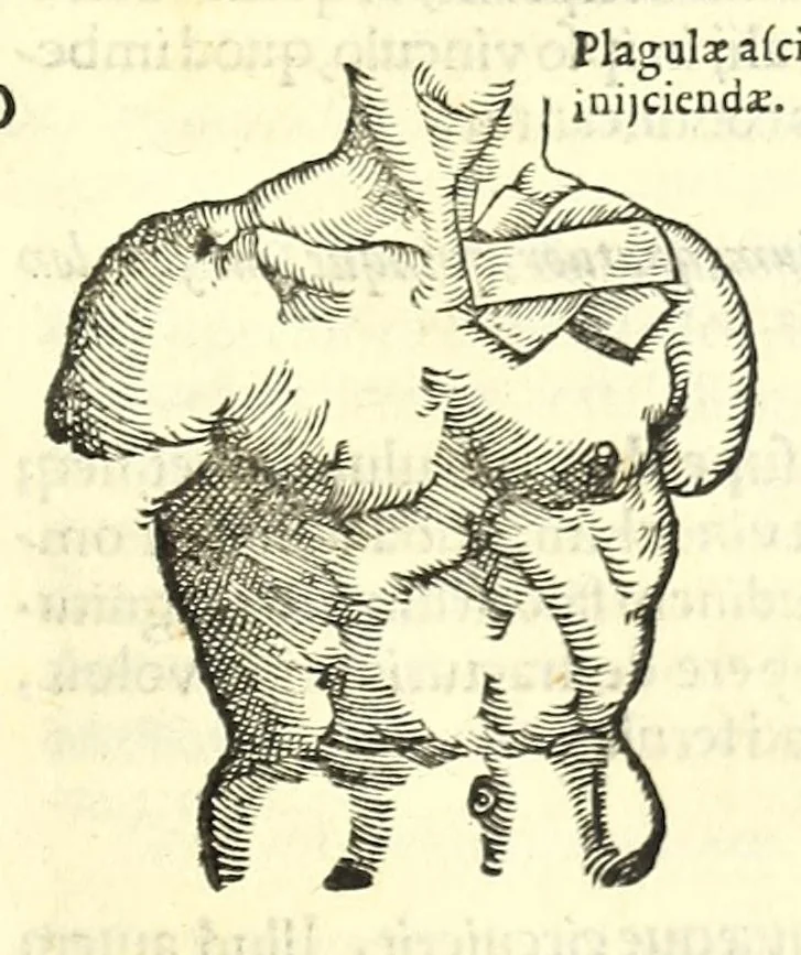An illustration from Galeni librorum septima classis : curativum methodum tum diffuse tum breviter descriptam, victus rationem in morbis acutis, singulorum morborum facile paranda remedia, privatam quorundam morborum curationem, chirurgie constitutionem, fracturarum ac luxationum sanationem, fasciarum deniq ; & laqueorum & machinamentorum tractatum continet, 1576, leaf 449