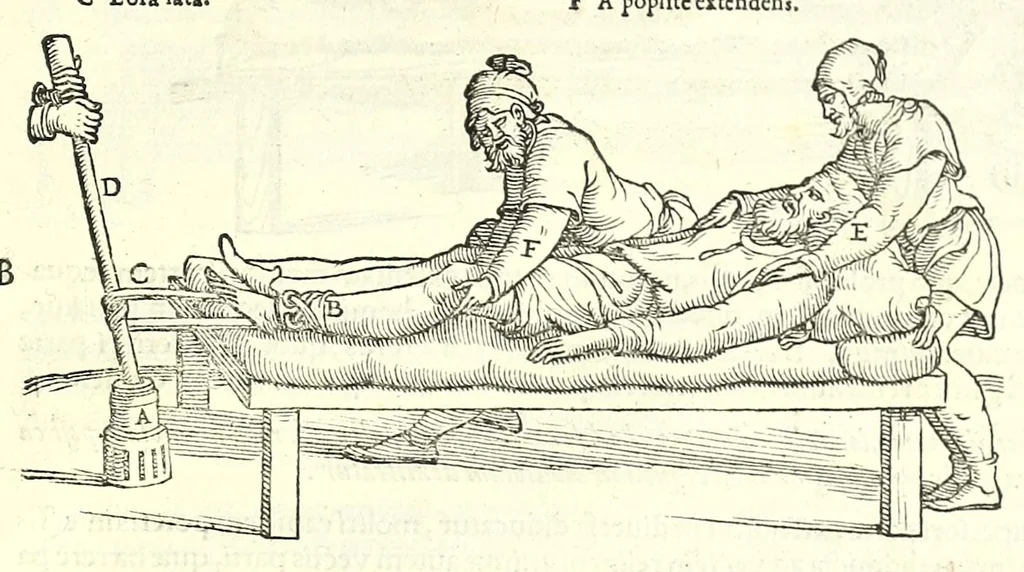 An illustration from Galeni librorum septima classis : curativum methodum tum diffuse tum breviter descriptam, victus rationem in morbis acutis, singulorum morborum facile paranda remedia, privatam quorundam morborum curationem, chirurgie constitutionem, fracturarum ac luxationum sanationem, fasciarum deniq ; & laqueorum & machinamentorum tractatum continet, 1576, leaf 495