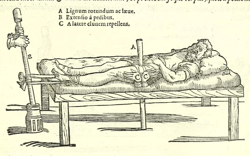An illustration from Galeni librorum septima classis : curativum methodum tum diffuse tum breviter descriptam, victus rationem in morbis acutis, singulorum morborum facile paranda remedia, privatam quorundam morborum curationem, chirurgie constitutionem, fracturarum ac luxationum sanationem, fasciarum deniq ; & laqueorum & machinamentorum tractatum continet, 1576, leaf 495