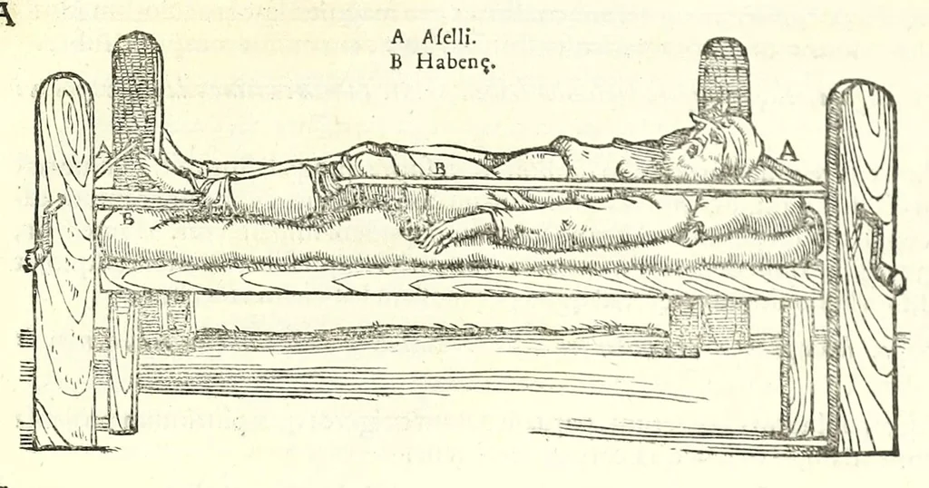 An illustration from Galeni librorum septima classis : curativum methodum tum diffuse tum breviter descriptam, victus rationem in morbis acutis, singulorum morborum facile paranda remedia, privatam quorundam morborum curationem, chirurgie constitutionem, fracturarum ac luxationum sanationem, fasciarum deniq ; & laqueorum & machinamentorum tractatum continet, 1576, leaf 497
