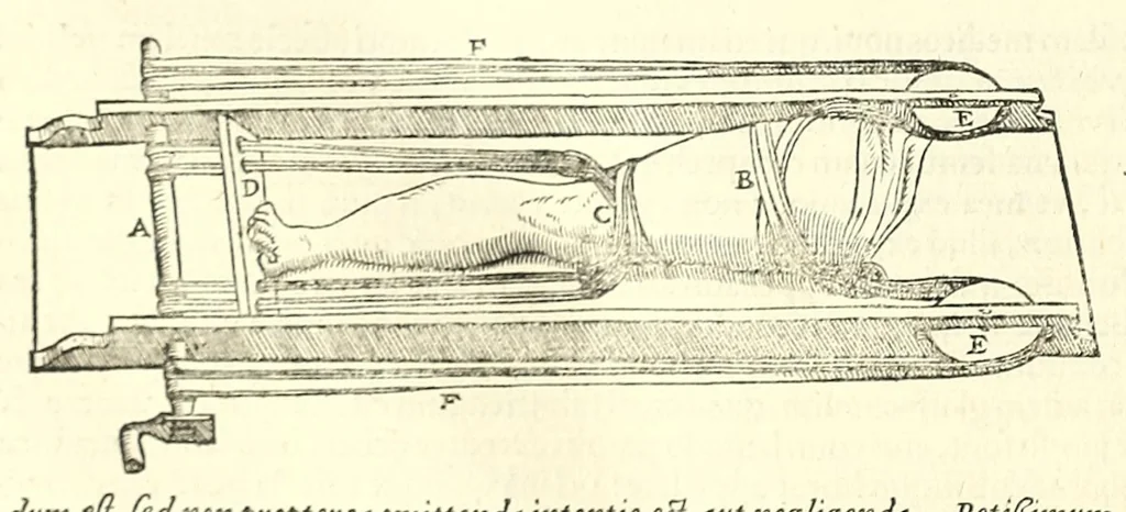 An illustration from Galeni librorum septima classis : curativum methodum tum diffuse tum breviter descriptam, victus rationem in morbis acutis, singulorum morborum facile paranda remedia, privatam quorundam morborum curationem, chirurgie constitutionem, fracturarum ac luxationum sanationem, fasciarum deniq ; & laqueorum & machinamentorum tractatum continet, 1576, leaf 500