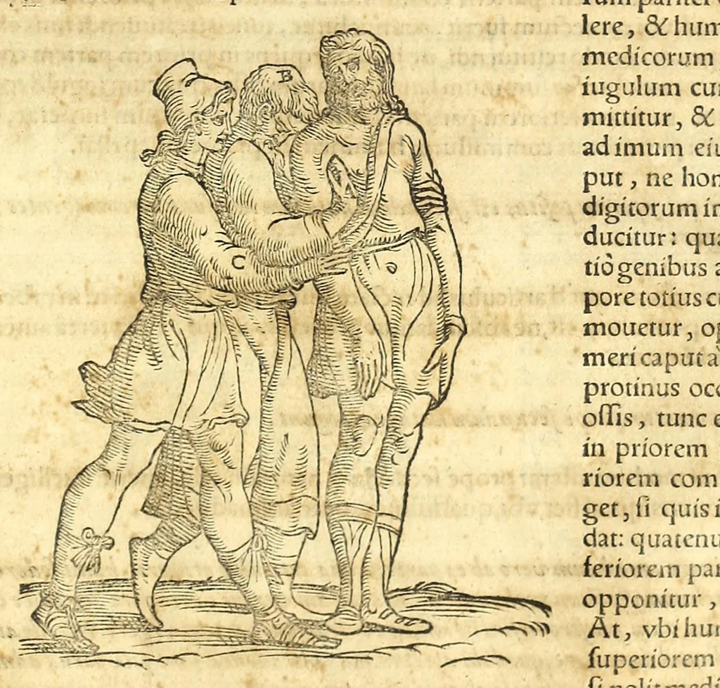 An illustration from Galeni librorum septima classis : curativum methodum tum diffuse tum breviter descriptam, victus rationem in morbis acutis, singulorum morborum facile paranda remedia, privatam quorundam morborum curationem, chirurgie constitutionem, fracturarum ac luxationum sanationem, fasciarum deniq ; & laqueorum & machinamentorum tractatum continet, 1576, leaf 527