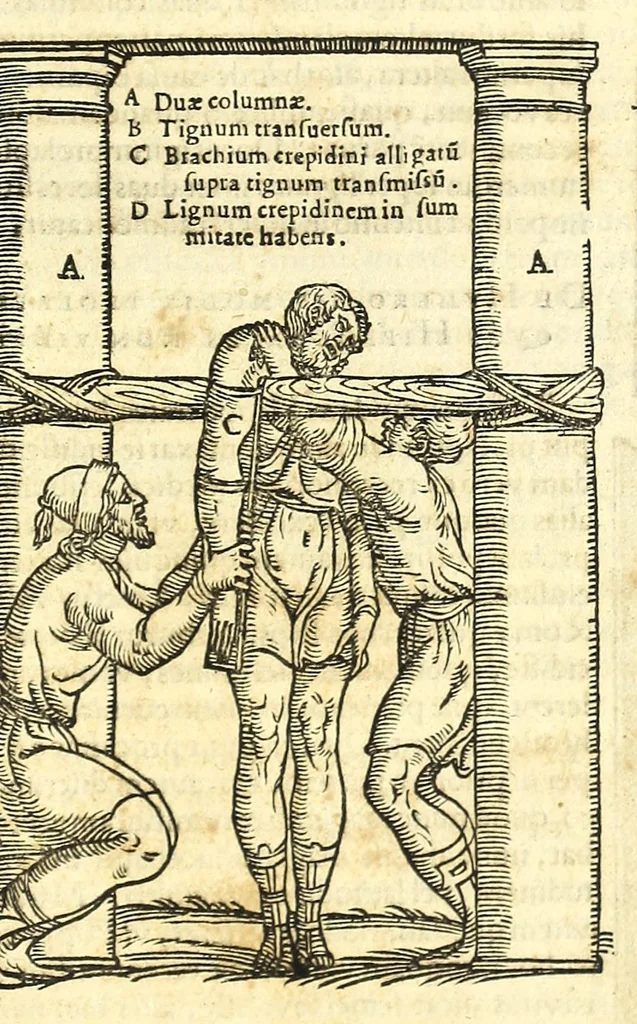 An illustration from Galeni librorum septima classis : curativum methodum tum diffuse tum breviter descriptam, victus rationem in morbis acutis, singulorum morborum facile paranda remedia, privatam quorundam morborum curationem, chirurgie constitutionem, fracturarum ac luxationum sanationem, fasciarum deniq ; & laqueorum & machinamentorum tractatum continet, 1576, leaf 531