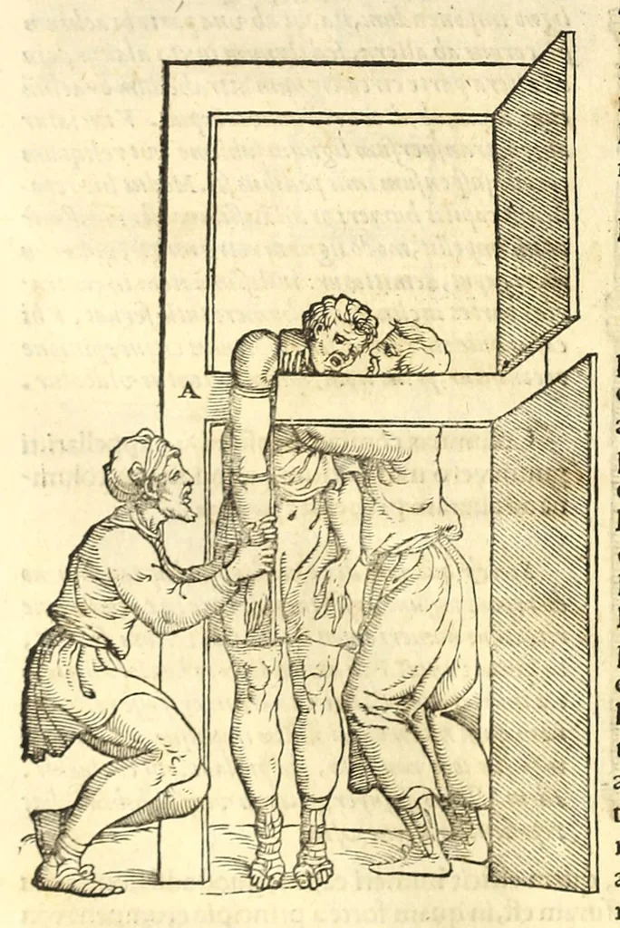 An illustration from Galeni librorum septima classis : curativum methodum tum diffuse tum breviter descriptam, victus rationem in morbis acutis, singulorum morborum facile paranda remedia, privatam quorundam morborum curationem, chirurgie constitutionem, fracturarum ac luxationum sanationem, fasciarum deniq ; & laqueorum & machinamentorum tractatum continet, 1576, leaf 532