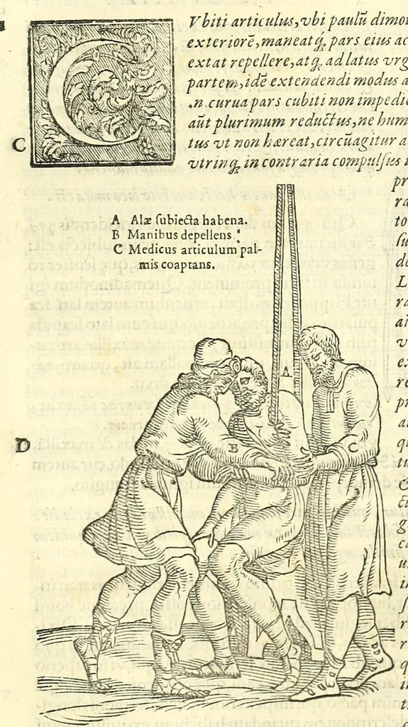 An illustration from Galeni librorum septima classis : curativum methodum tum diffuse tum breviter descriptam, victus rationem in morbis acutis, singulorum morborum facile paranda remedia, privatam quorundam morborum curationem, chirurgie constitutionem, fracturarum ac luxationum sanationem, fasciarum deniq ; & laqueorum & machinamentorum tractatum continet, 1576, leaf 545