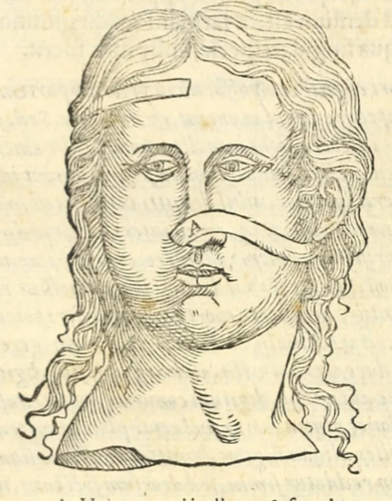 An illustration from Galeni librorum septima classis : curativum methodum tum diffuse tum breviter descriptam, victus rationem in morbis acutis, singulorum morborum facile paranda remedia, privatam quorundam morborum curationem, chirurgie constitutionem, fracturarum ac luxationum sanationem, fasciarum deniq ; & laqueorum & machinamentorum tractatum continet, 1576, leaf 556