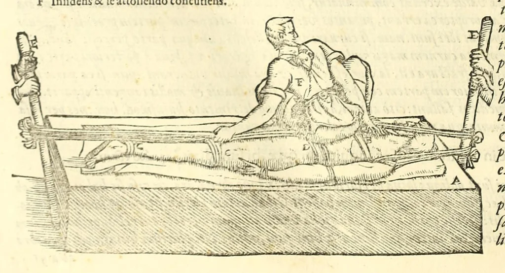 An illustration from Galeni librorum septima classis : curativum methodum tum diffuse tum breviter descriptam, victus rationem in morbis acutis, singulorum morborum facile paranda remedia, privatam quorundam morborum curationem, chirurgie constitutionem, fracturarum ac luxationum sanationem, fasciarum deniq ; & laqueorum & machinamentorum tractatum continet, 1576, leaf 568