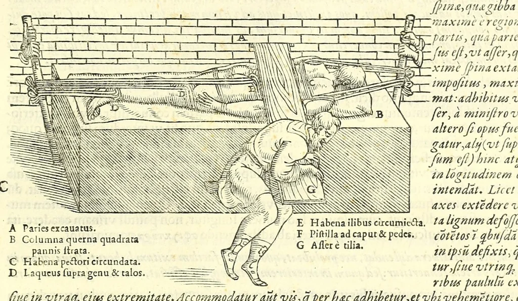 An illustration from Galeni librorum septima classis : curativum methodum tum diffuse tum breviter descriptam, victus rationem in morbis acutis, singulorum morborum facile paranda remedia, privatam quorundam morborum curationem, chirurgie constitutionem, fracturarum ac luxationum sanationem, fasciarum deniq ; & laqueorum & machinamentorum tractatum continet, 1576, leaf 569