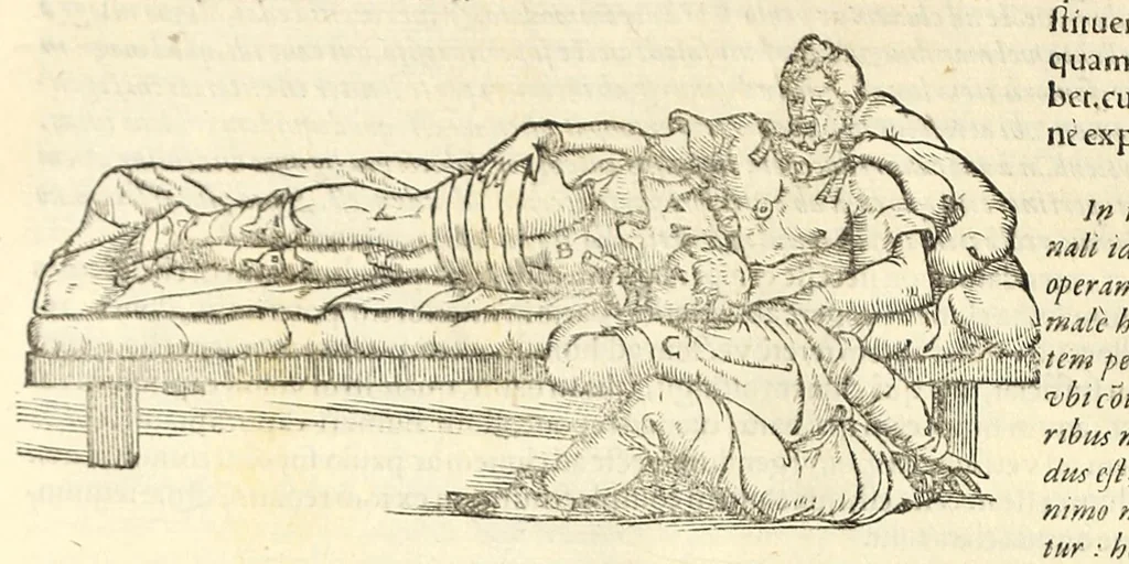 An illustration from Galeni librorum septima classis : curativum methodum tum diffuse tum breviter descriptam, victus rationem in morbis acutis, singulorum morborum facile paranda remedia, privatam quorundam morborum curationem, chirurgie constitutionem, fracturarum ac luxationum sanationem, fasciarum deniq ; & laqueorum & machinamentorum tractatum continet, 1576, leaf 604