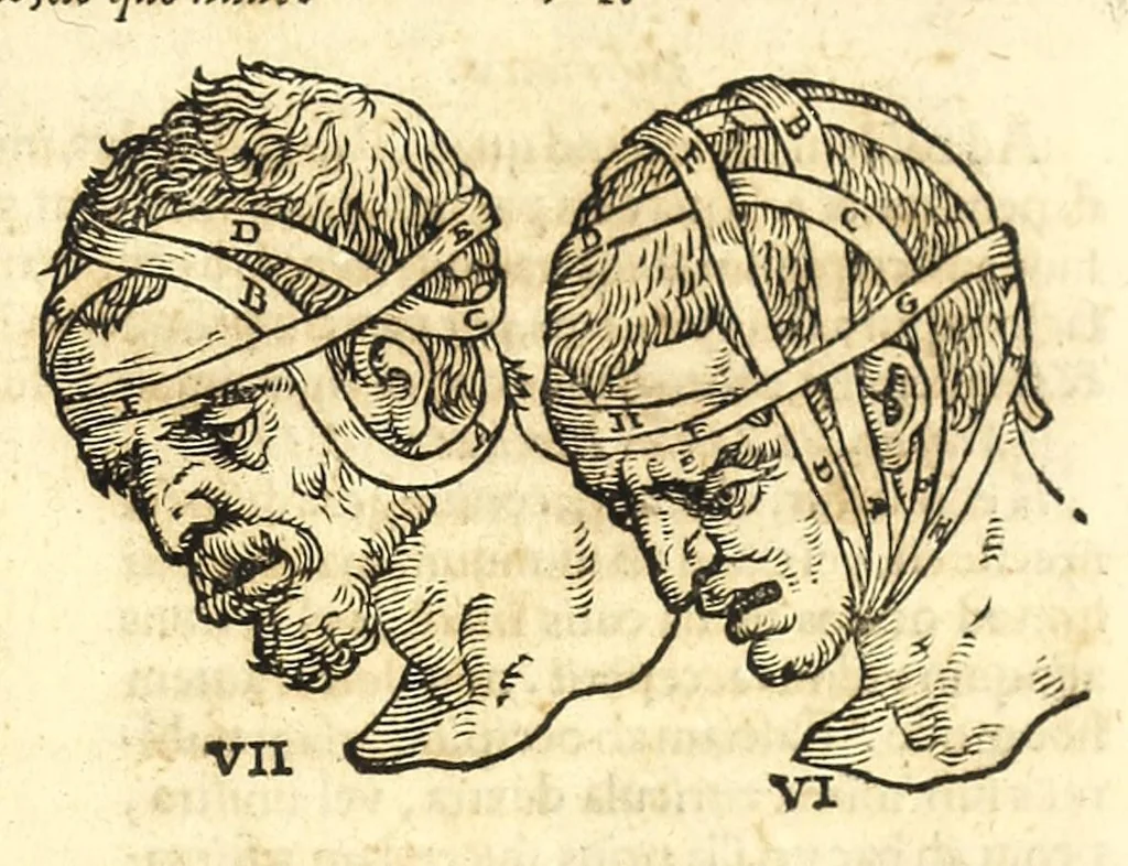 An illustration from Galeni librorum septima classis : curativum methodum tum diffuse tum breviter descriptam, victus rationem in morbis acutis, singulorum morborum facile paranda remedia, privatam quorundam morborum curationem, chirurgie constitutionem, fracturarum ac luxationum sanationem, fasciarum deniq ; & laqueorum & machinamentorum tractatum continet, 1576, leaf 611
