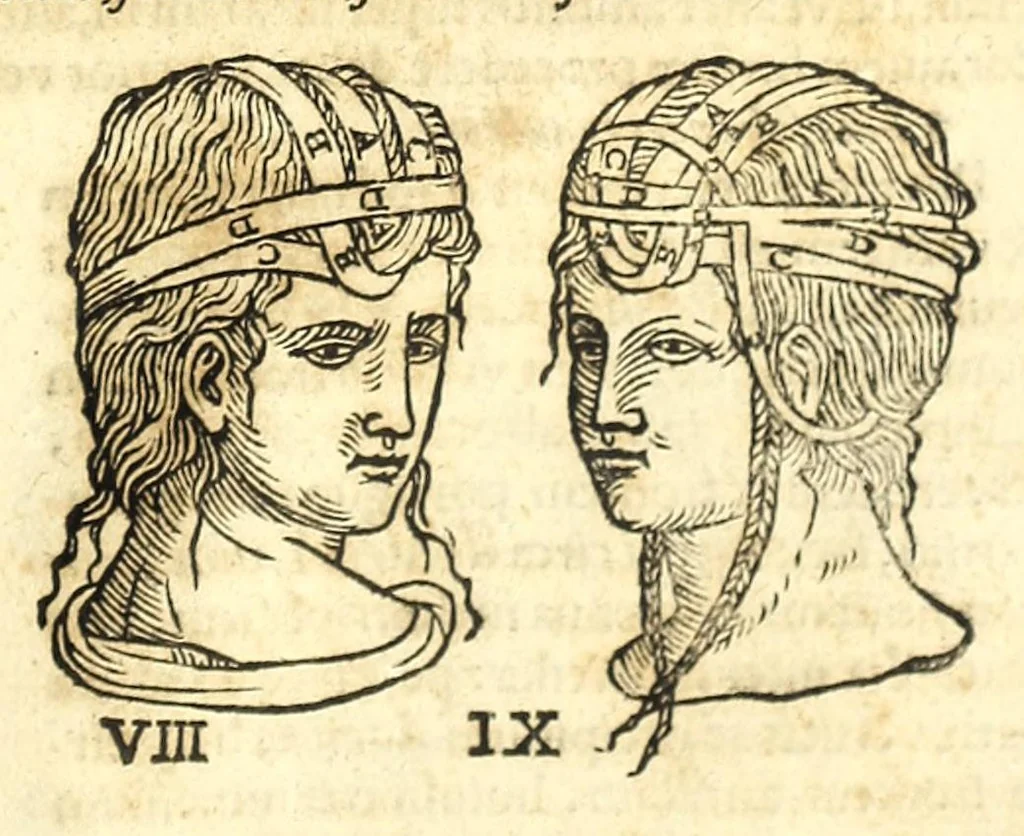 An illustration from Galeni librorum septima classis : curativum methodum tum diffuse tum breviter descriptam, victus rationem in morbis acutis, singulorum morborum facile paranda remedia, privatam quorundam morborum curationem, chirurgie constitutionem, fracturarum ac luxationum sanationem, fasciarum deniq ; & laqueorum & machinamentorum tractatum continet, 1576, leaf 611