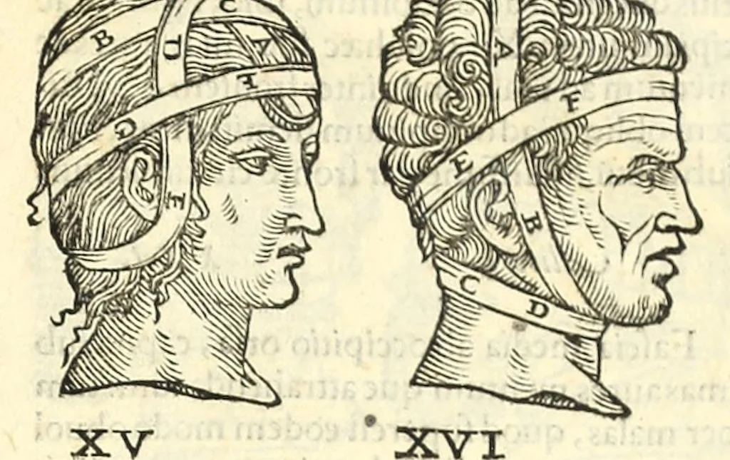 An illustration from Galeni librorum septima classis : curativum methodum tum diffuse tum breviter descriptam, victus rationem in morbis acutis, singulorum morborum facile paranda remedia, privatam quorundam morborum curationem, chirurgie constitutionem, fracturarum ac luxationum sanationem, fasciarum deniq ; & laqueorum & machinamentorum tractatum continet, 1576, leaf 613