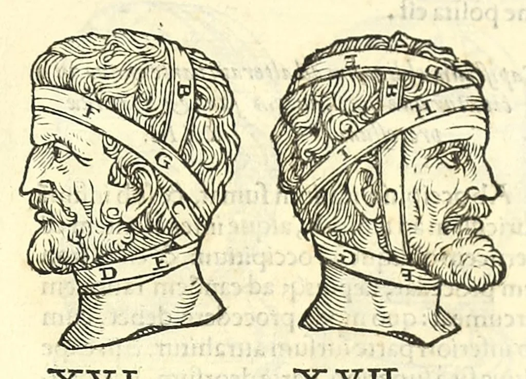 An illustration from Galeni librorum septima classis : curativum methodum tum diffuse tum breviter descriptam, victus rationem in morbis acutis, singulorum morborum facile paranda remedia, privatam quorundam morborum curationem, chirurgie constitutionem, fracturarum ac luxationum sanationem, fasciarum deniq ; & laqueorum & machinamentorum tractatum continet, 1576, leaf 613
