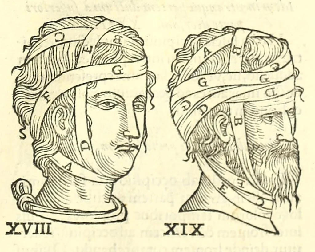 An illustration from Galeni librorum septima classis : curativum methodum tum diffuse tum breviter descriptam, victus rationem in morbis acutis, singulorum morborum facile paranda remedia, privatam quorundam morborum curationem, chirurgie constitutionem, fracturarum ac luxationum sanationem, fasciarum deniq ; & laqueorum & machinamentorum tractatum continet, 1576, leaf 613