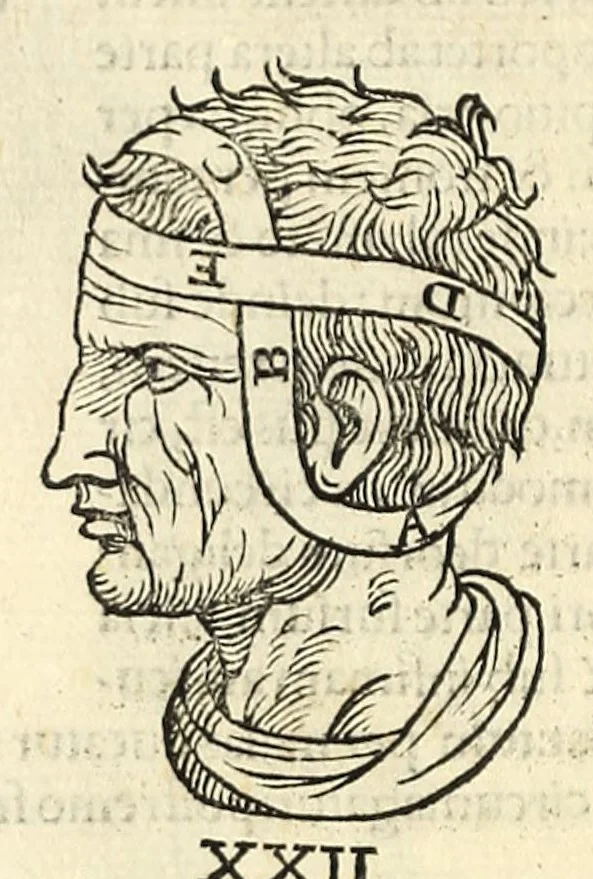 An illustration from Galeni librorum septima classis : curativum methodum tum diffuse tum breviter descriptam, victus rationem in morbis acutis, singulorum morborum facile paranda remedia, privatam quorundam morborum curationem, chirurgie constitutionem, fracturarum ac luxationum sanationem, fasciarum deniq ; & laqueorum & machinamentorum tractatum continet, 1576, leaf 614