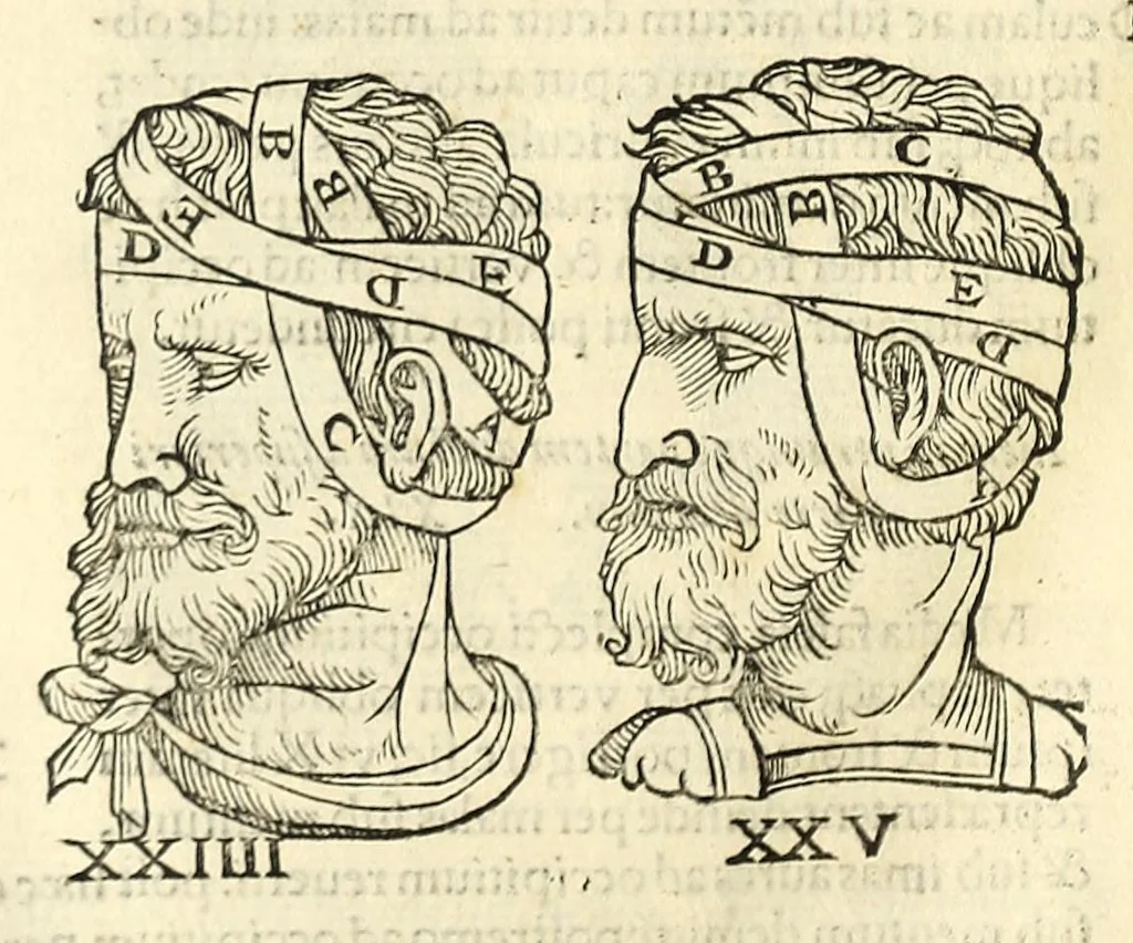 An illustration from Galeni librorum septima classis : curativum methodum tum diffuse tum breviter descriptam, victus rationem in morbis acutis, singulorum morborum facile paranda remedia, privatam quorundam morborum curationem, chirurgie constitutionem, fracturarum ac luxationum sanationem, fasciarum deniq ; & laqueorum & machinamentorum tractatum continet, 1576, leaf 614