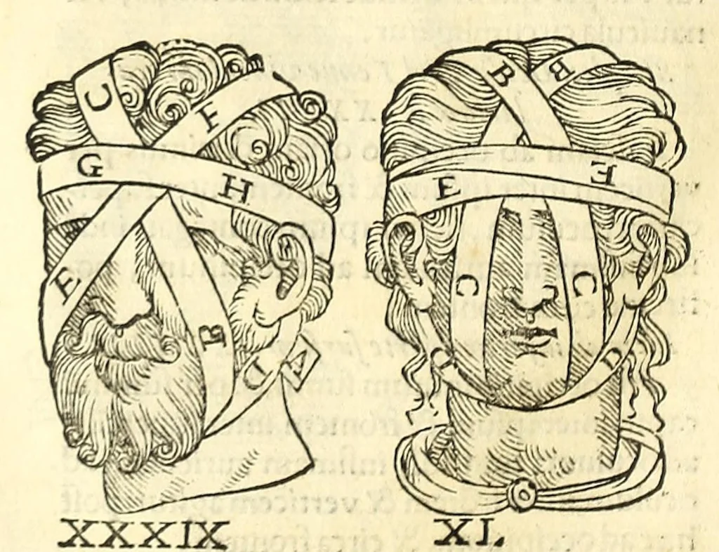 An illustration from Galeni librorum septima classis : curativum methodum tum diffuse tum breviter descriptam, victus rationem in morbis acutis, singulorum morborum facile paranda remedia, privatam quorundam morborum curationem, chirurgie constitutionem, fracturarum ac luxationum sanationem, fasciarum deniq ; & laqueorum & machinamentorum tractatum continet, 1576, leaf 616