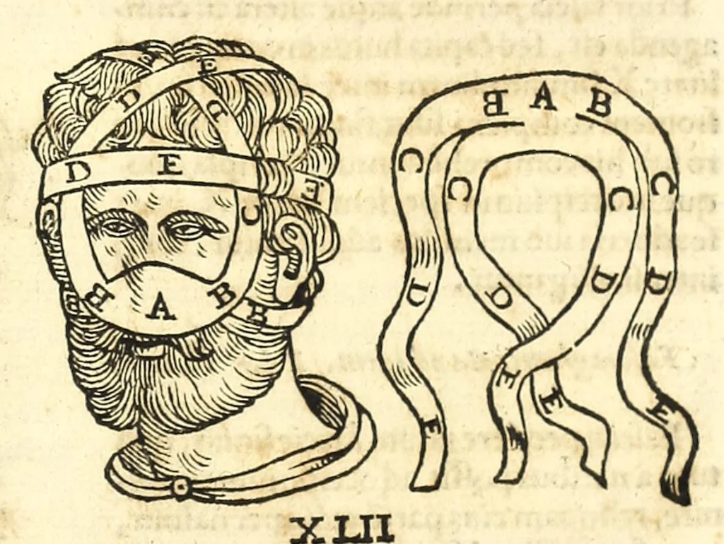 An illustration from Galeni librorum septima classis : curativum methodum tum diffuse tum breviter descriptam, victus rationem in morbis acutis, singulorum morborum facile paranda remedia, privatam quorundam morborum curationem, chirurgie constitutionem, fracturarum ac luxationum sanationem, fasciarum deniq ; & laqueorum & machinamentorum tractatum continet, 1576, leaf 617