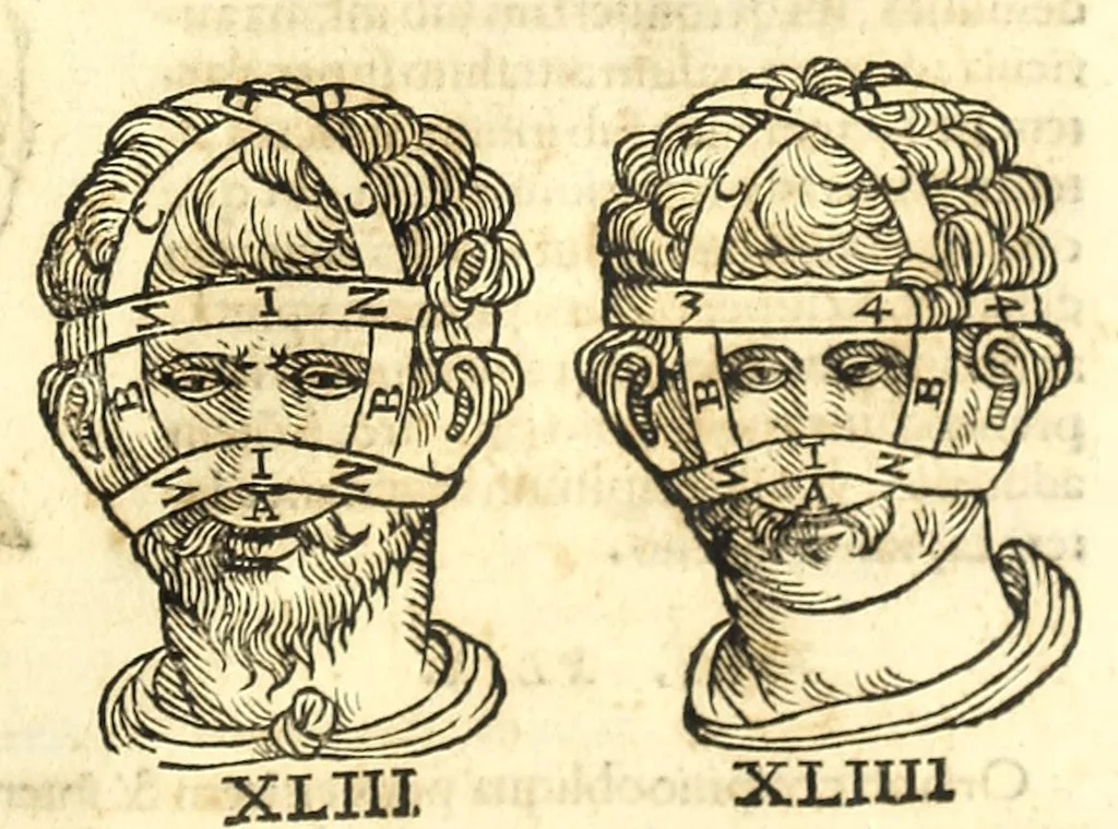 An illustration from Galeni librorum septima classis : curativum methodum tum diffuse tum breviter descriptam, victus rationem in morbis acutis, singulorum morborum facile paranda remedia, privatam quorundam morborum curationem, chirurgie constitutionem, fracturarum ac luxationum sanationem, fasciarum deniq ; & laqueorum & machinamentorum tractatum continet, 1576, leaf 617