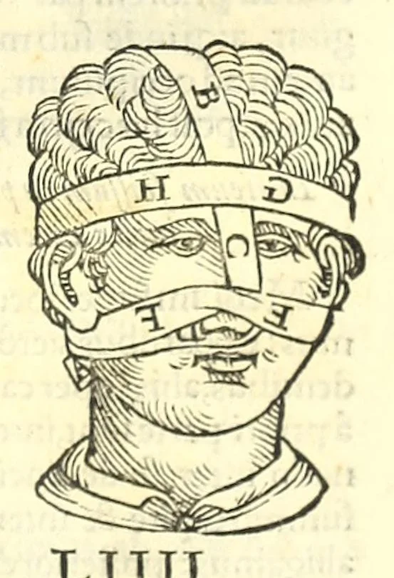 An illustration from Galeni librorum septima classis : curativum methodum tum diffuse tum breviter descriptam, victus rationem in morbis acutis, singulorum morborum facile paranda remedia, privatam quorundam morborum curationem, chirurgie constitutionem, fracturarum ac luxationum sanationem, fasciarum deniq ; & laqueorum & machinamentorum tractatum continet, 1576, leaf 619
