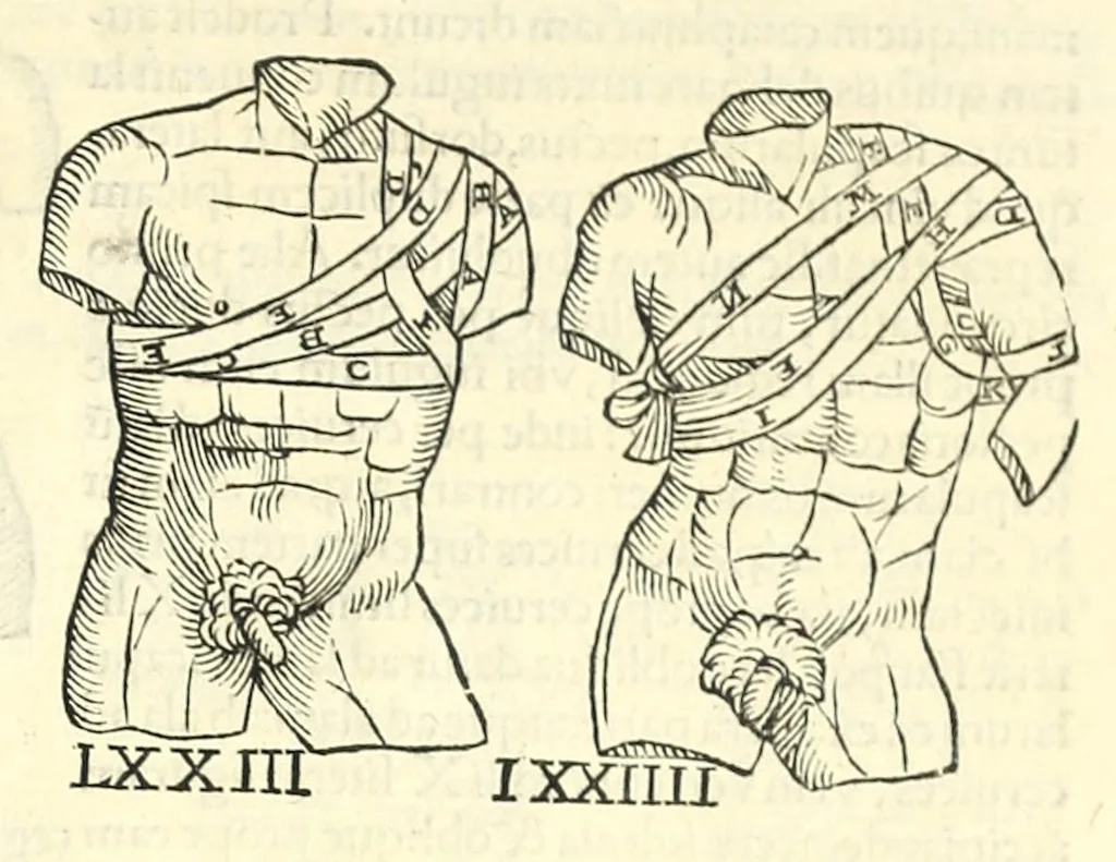 An illustration from Galeni librorum septima classis : curativum methodum tum diffuse tum breviter descriptam, victus rationem in morbis acutis, singulorum morborum facile paranda remedia, privatam quorundam morborum curationem, chirurgie constitutionem, fracturarum ac luxationum sanationem, fasciarum deniq ; & laqueorum & machinamentorum tractatum continet, 1576, leaf 623