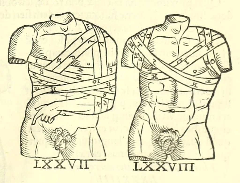 An illustration from Galeni librorum septima classis : curativum methodum tum diffuse tum breviter descriptam, victus rationem in morbis acutis, singulorum morborum facile paranda remedia, privatam quorundam morborum curationem, chirurgie constitutionem, fracturarum ac luxationum sanationem, fasciarum deniq ; & laqueorum & machinamentorum tractatum continet, 1576, leaf 623