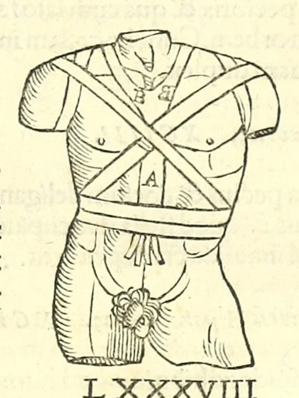 An illustration from Galeni librorum septima classis : curativum methodum tum diffuse tum breviter descriptam, victus rationem in morbis acutis, singulorum morborum facile paranda remedia, privatam quorundam morborum curationem, chirurgie constitutionem, fracturarum ac luxationum sanationem, fasciarum deniq ; & laqueorum & machinamentorum tractatum continet, 1576, leaf 625
