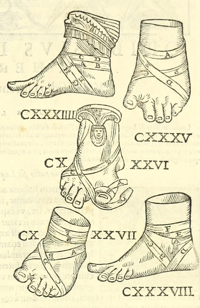 An illustration from Galeni librorum septima classis : curativum methodum tum diffuse tum breviter descriptam, victus rationem in morbis acutis, singulorum morborum facile paranda remedia, privatam quorundam morborum curationem, chirurgie constitutionem, fracturarum ac luxationum sanationem, fasciarum deniq ; & laqueorum & machinamentorum tractatum continet, 1576, leaf 633