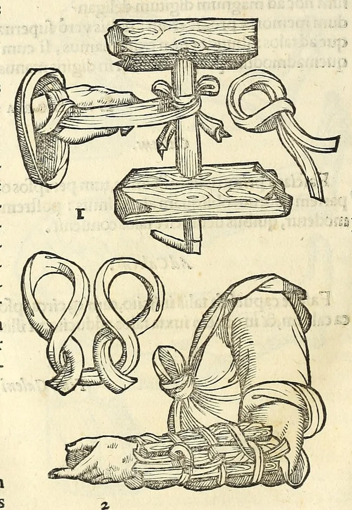 An illustration from Galeni librorum septima classis : curativum methodum tum diffuse tum breviter descriptam, victus rationem in morbis acutis, singulorum morborum facile paranda remedia, privatam quorundam morborum curationem, chirurgie constitutionem, fracturarum ac luxationum sanationem, fasciarum deniq ; & laqueorum & machinamentorum tractatum continet, 1576, leaf 634