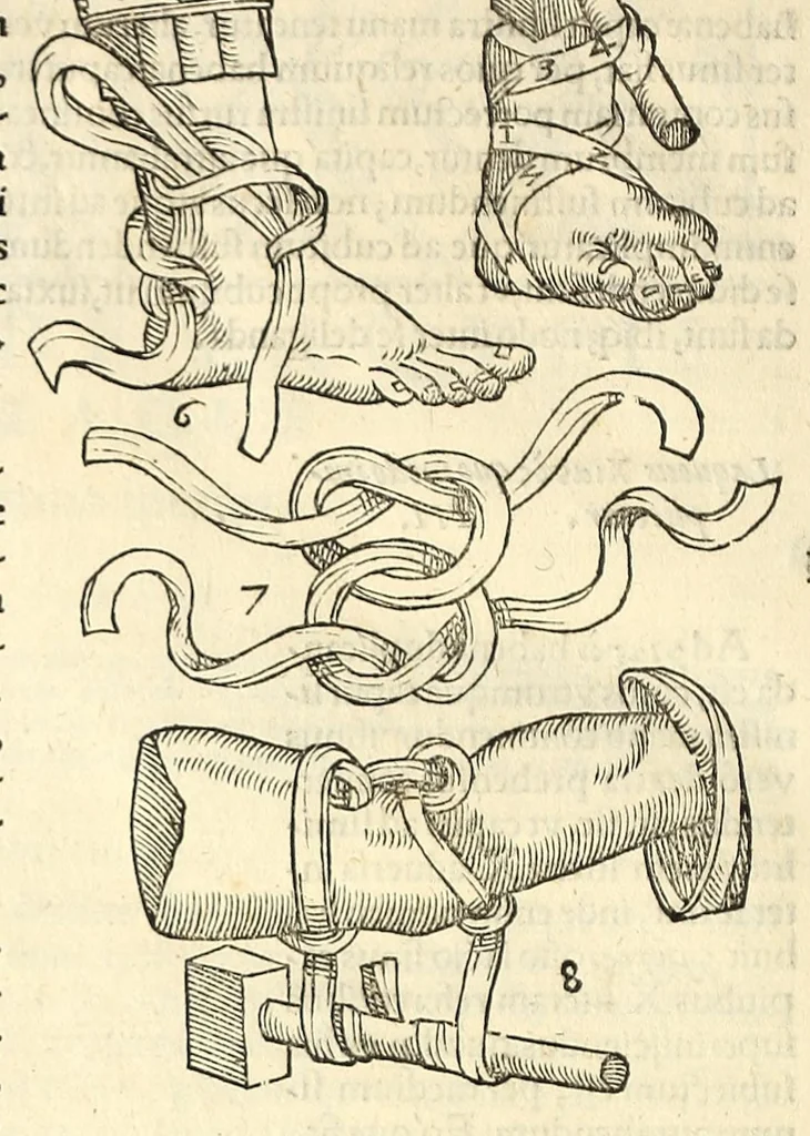 An illustration from Galeni librorum septima classis : curativum methodum tum diffuse tum breviter descriptam, victus rationem in morbis acutis, singulorum morborum facile paranda remedia, privatam quorundam morborum curationem, chirurgie constitutionem, fracturarum ac luxationum sanationem, fasciarum deniq ; & laqueorum & machinamentorum tractatum continet, 1576, leaf 636