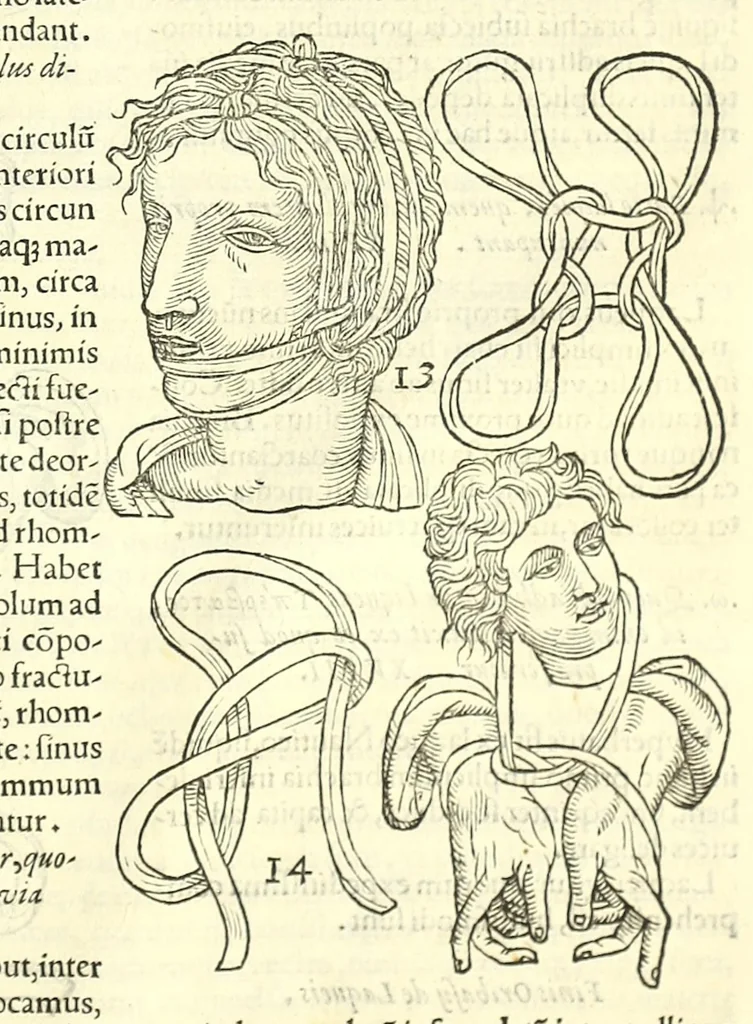 An illustration from Galeni librorum septima classis : curativum methodum tum diffuse tum breviter descriptam, victus rationem in morbis acutis, singulorum morborum facile paranda remedia, privatam quorundam morborum curationem, chirurgie constitutionem, fracturarum ac luxationum sanationem, fasciarum deniq ; & laqueorum & machinamentorum tractatum continet, 1576, leaf 637