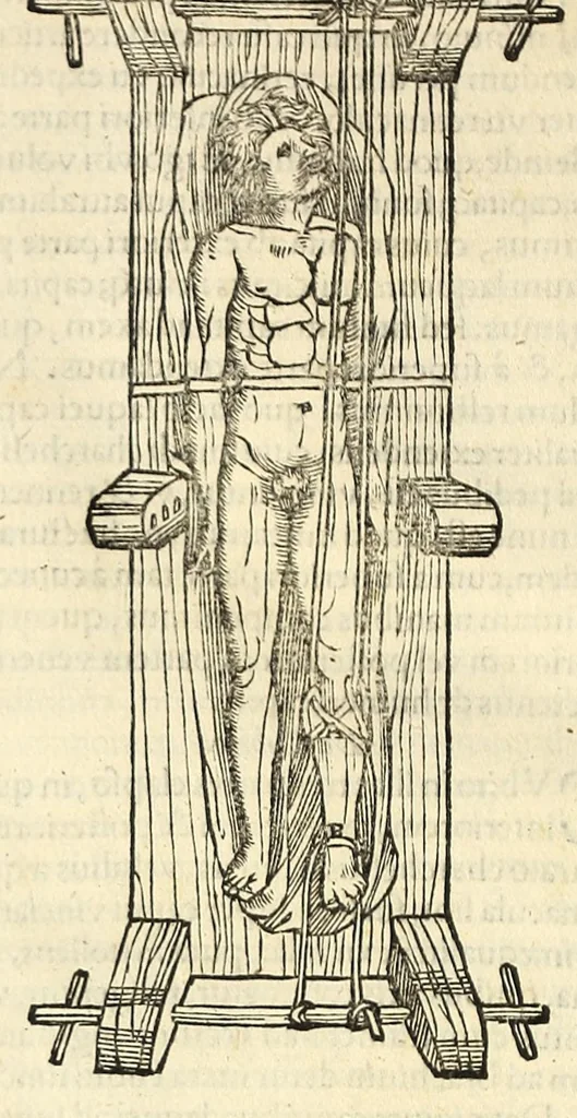 An illustration from Galeni librorum septima classis : curativum methodum tum diffuse tum breviter descriptam, victus rationem in morbis acutis, singulorum morborum facile paranda remedia, privatam quorundam morborum curationem, chirurgie constitutionem, fracturarum ac luxationum sanationem, fasciarum deniq ; & laqueorum & machinamentorum tractatum continet, 1576, leaf 662