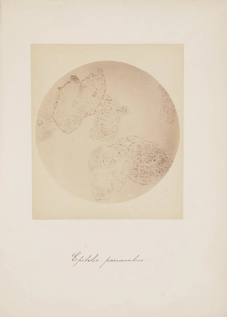 An illustration from [Applicazione della fotografia alla microscopia], 1870, leaf 25