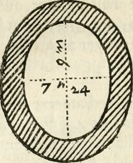 An illustration from Architecture pratique : qui comprend la construction générale et particuliere des bâtimens, le détail, les toisé et devis de chaque partie ... : avec une explication et une conférence de trente-six articles de la coutume de Paris, sur le titre des servitudes & rapports qui concernent les bâtimens, & de l'ordonnance de 1673, 1780, leaf 205