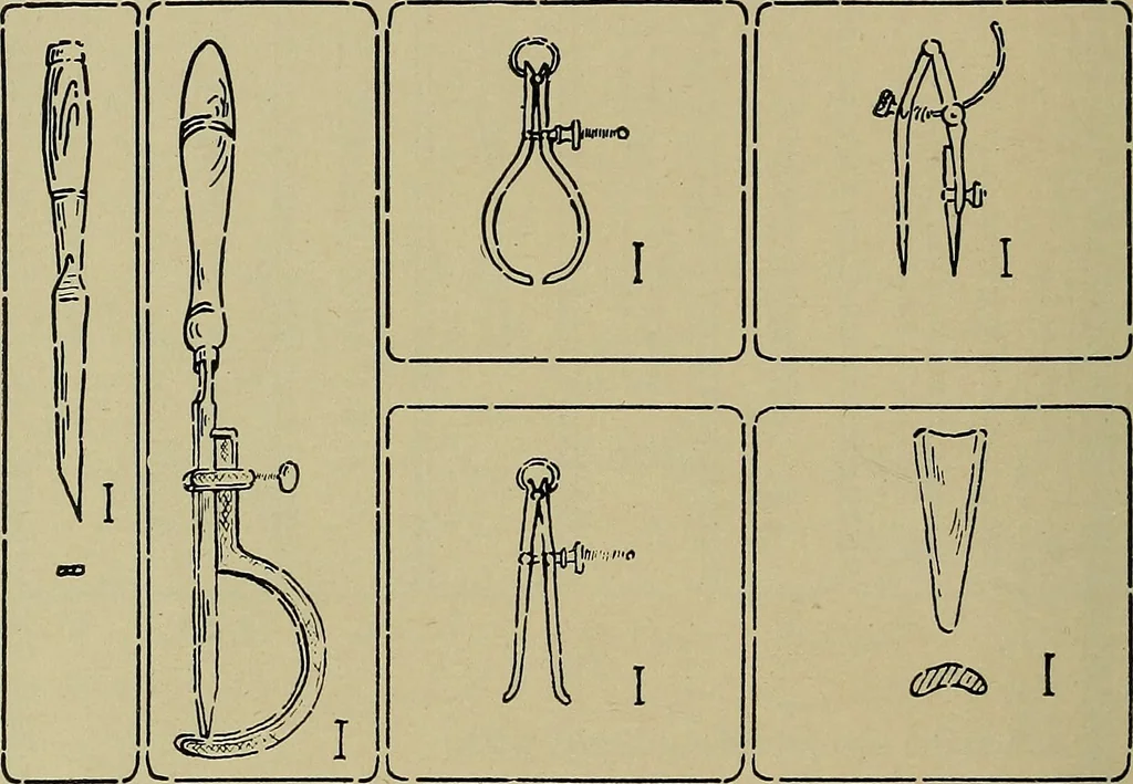 An illustration from Art and education in wood-turning;, 1921, leaf 17