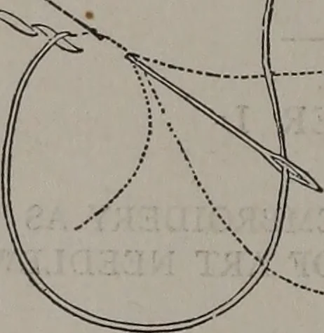 An illustration from Art-needlework for decorative embroidery : a guide to embroidery in crewels, silks, appliqué, etc. ..., 1879, leaf 9