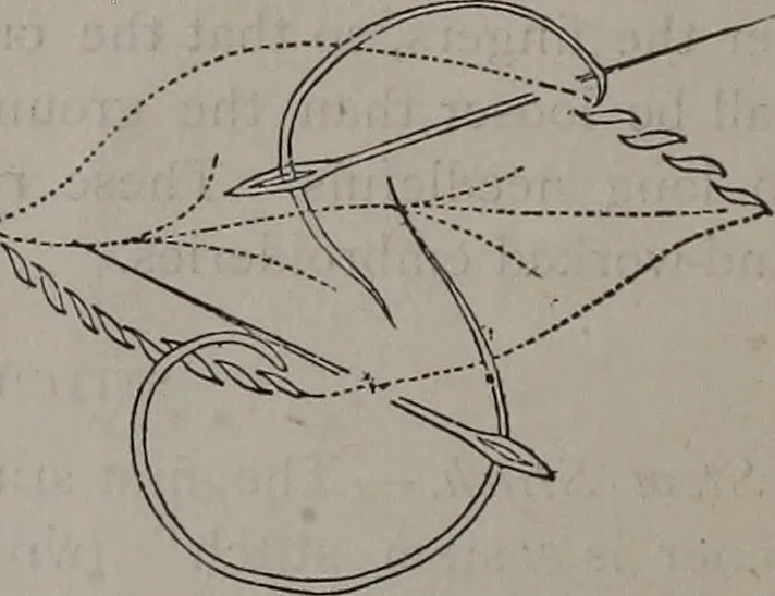 An illustration from Art-needlework for decorative embroidery : a guide to embroidery in crewels, silks, appliqué, etc. ..., 1879, leaf 9